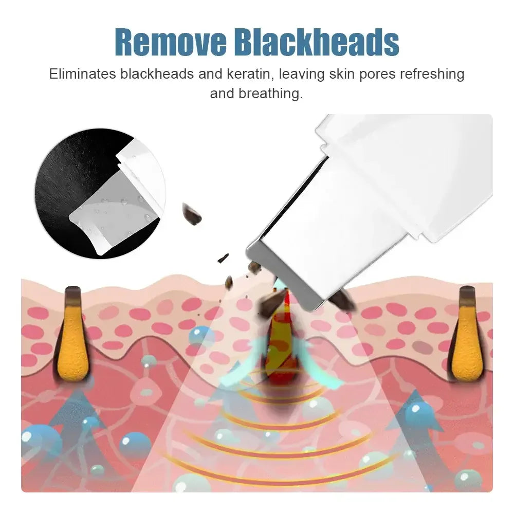 Espátula Vibratória de Limpeza Facial — Remove Pontos Negros e Esfoliante | AlivioPrime