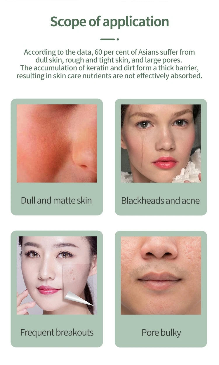Espátula Vibratória de Limpeza Facial — Remove Pontos Negros e Esfoliante | AlivioPrime