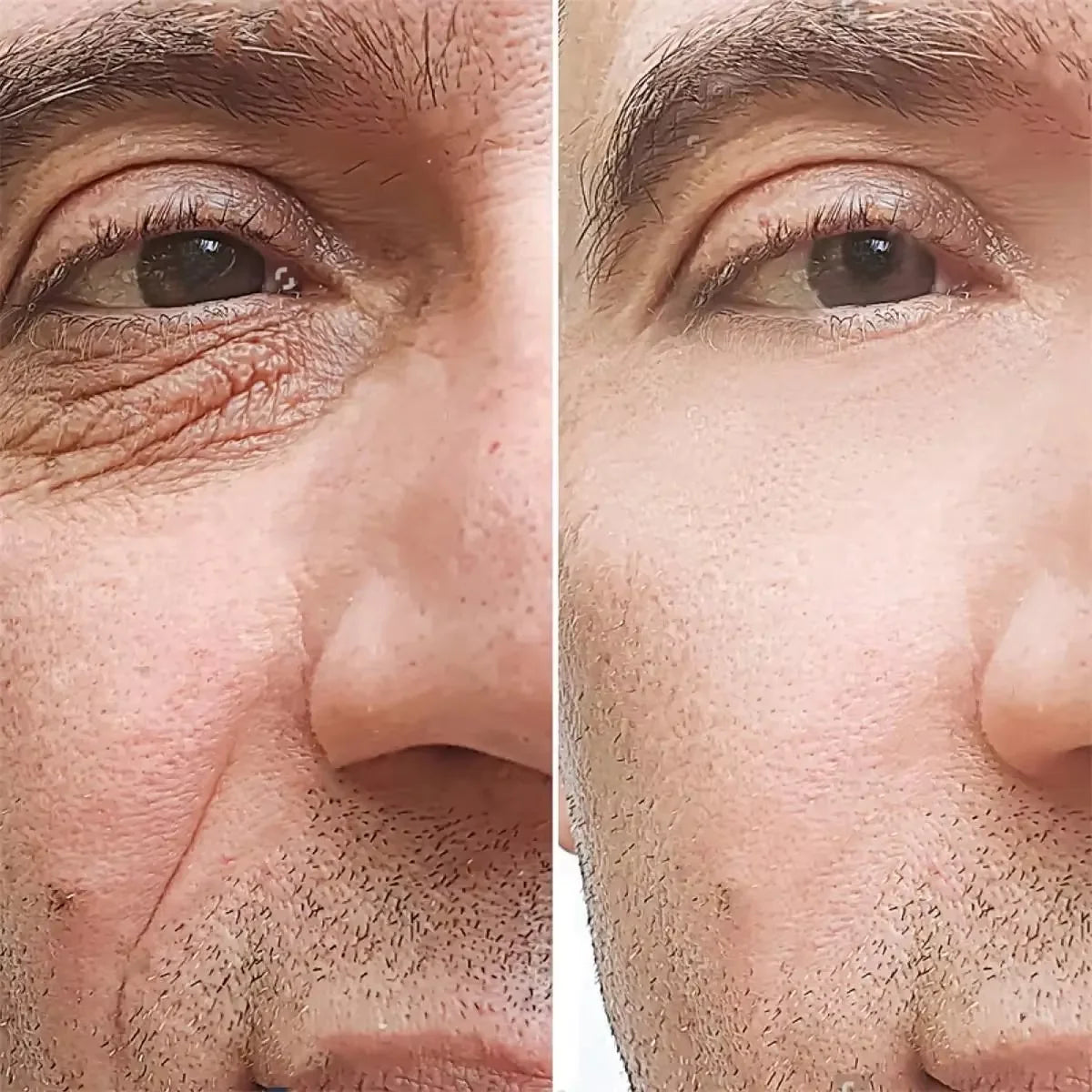 Creme de Retinol Anti-Rugas para Homem — Colágenio, Firmeza e Hidratação | AlivioPrime
