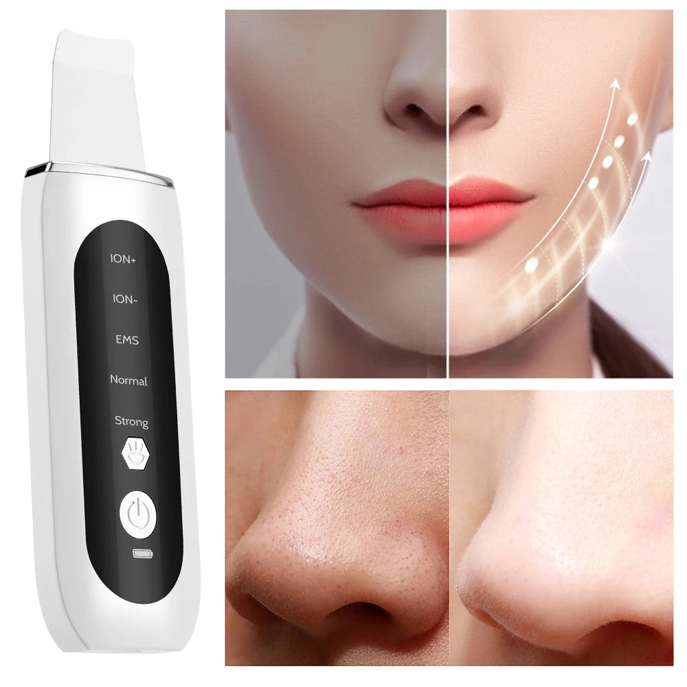 Esfoliador Ultrassónico EMS com Microcorrente — Lifting, Limpeza e Anti-Rugas | AlivioPrime