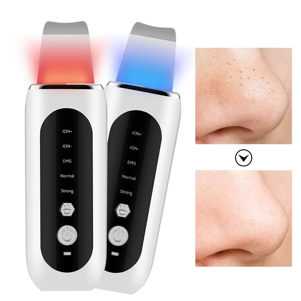 Esfoliador Ultrassónico EMS com Microcorrente — Lifting, Limpeza e Anti-Rugas | AlivioPrime