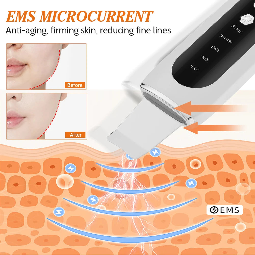 Esfoliador Ultrassónico EMS com Microcorrente — Lifting, Limpeza e Anti-Rugas | AlivioPrime