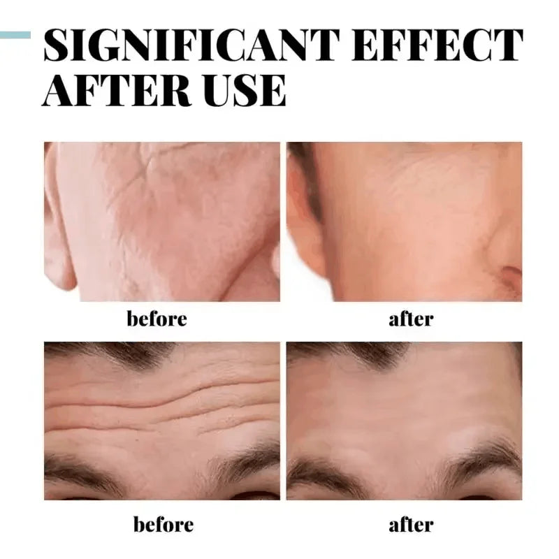 Creme de Retinol Anti-Rugas para Homem — Colágenio, Firmeza e Hidratação | AlivioPrime