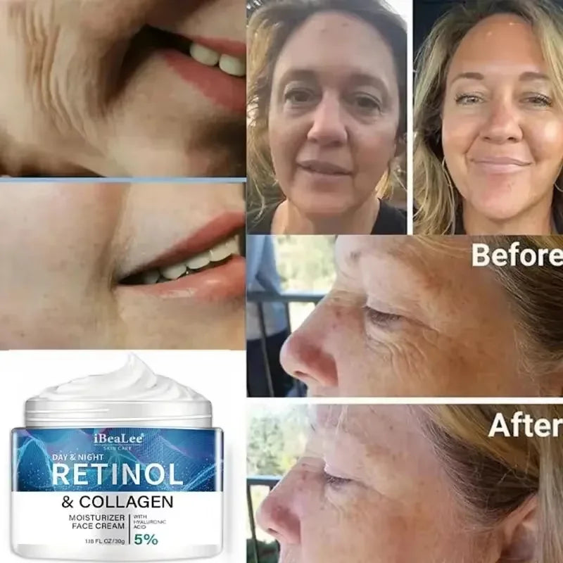 Creme de Retinol Anti-Rugas para Homem — Colágenio, Firmeza e Hidratação | AlivioPrime